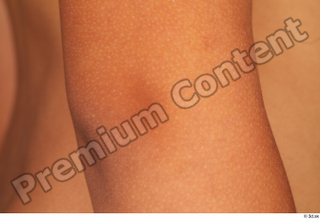 Timbo arm elbow 0006.jpg